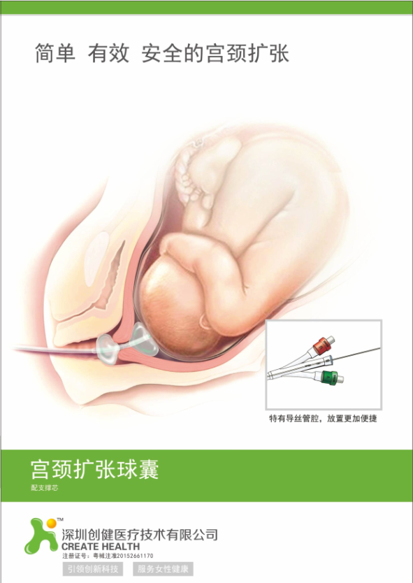 產(chǎn)科耗材子宮頸擴(kuò)張球囊   全國招商