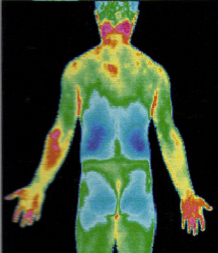 北京醫(yī)用紅外熱像儀 醫(yī)用紅熱成像檢測(cè)儀 醫(yī)院專供