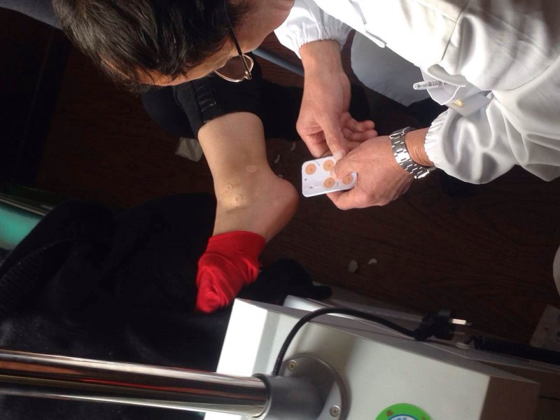 “卓脈“一次性使用無菌撳針（單層固定2.5）