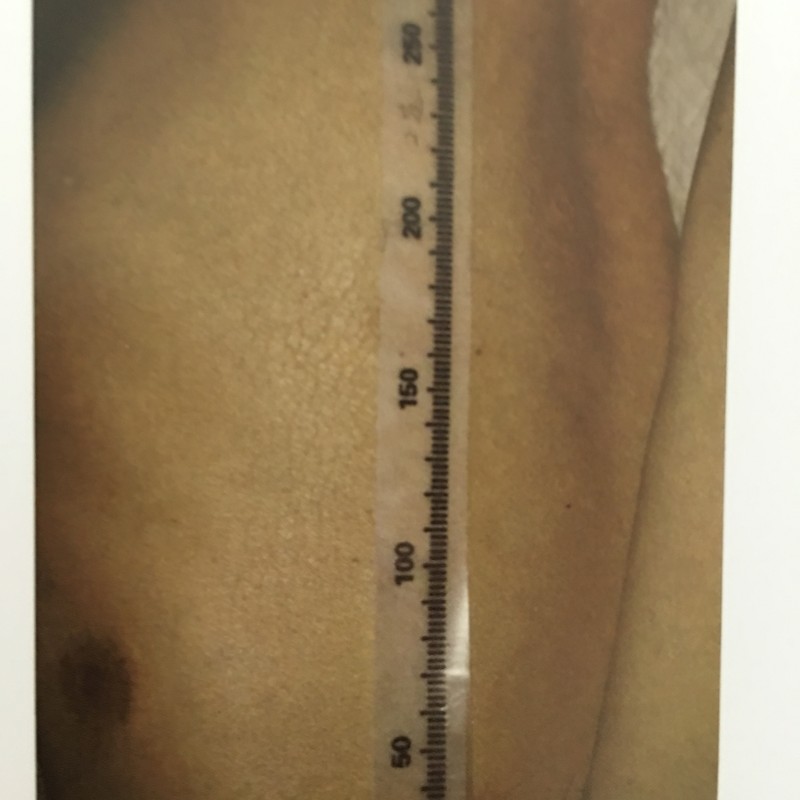 顯影膠帶百麗兒標(biāo)記尺