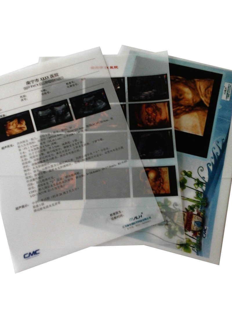 醫(yī)用打印膠片（商品名：超聲PACKS醫(yī)用診斷報(bào)告膠片）