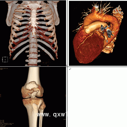 醫(yī)用膠片：藍基、瓷白、彩色影像膠片，影樓影像膠片