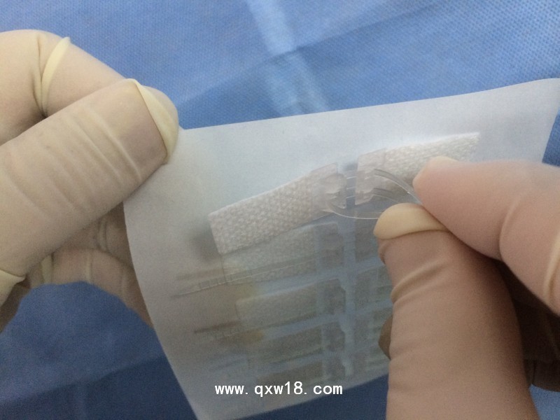 手術(shù)縫合拉扣