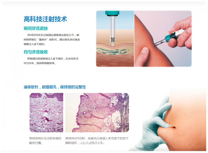 德國原裝無針注射器——益捷INJEX30【胰島素、生長激素】