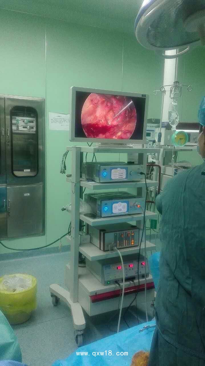 德國MGB高清腹腔鏡，高清膀胱鏡，高清輸尿管腎鏡，鼻竇鏡