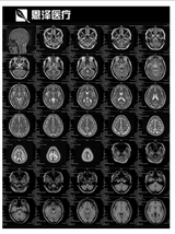 放射科紙質(zhì)膠片 醫(yī)用干式膠片 雙面圖文膠片 超聲及其他影像