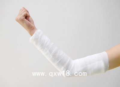 進口醫(yī)用高分子夾板 骨科夾板韓國進口ALPHA醫(yī)用高分子夾板