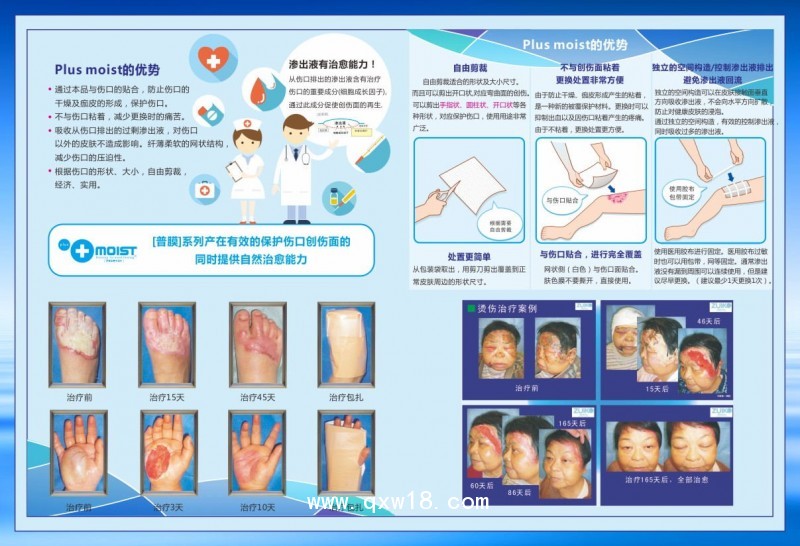 傷口敷貼護創(chuàng)材料敷料原裝進口新型護創(chuàng)材料