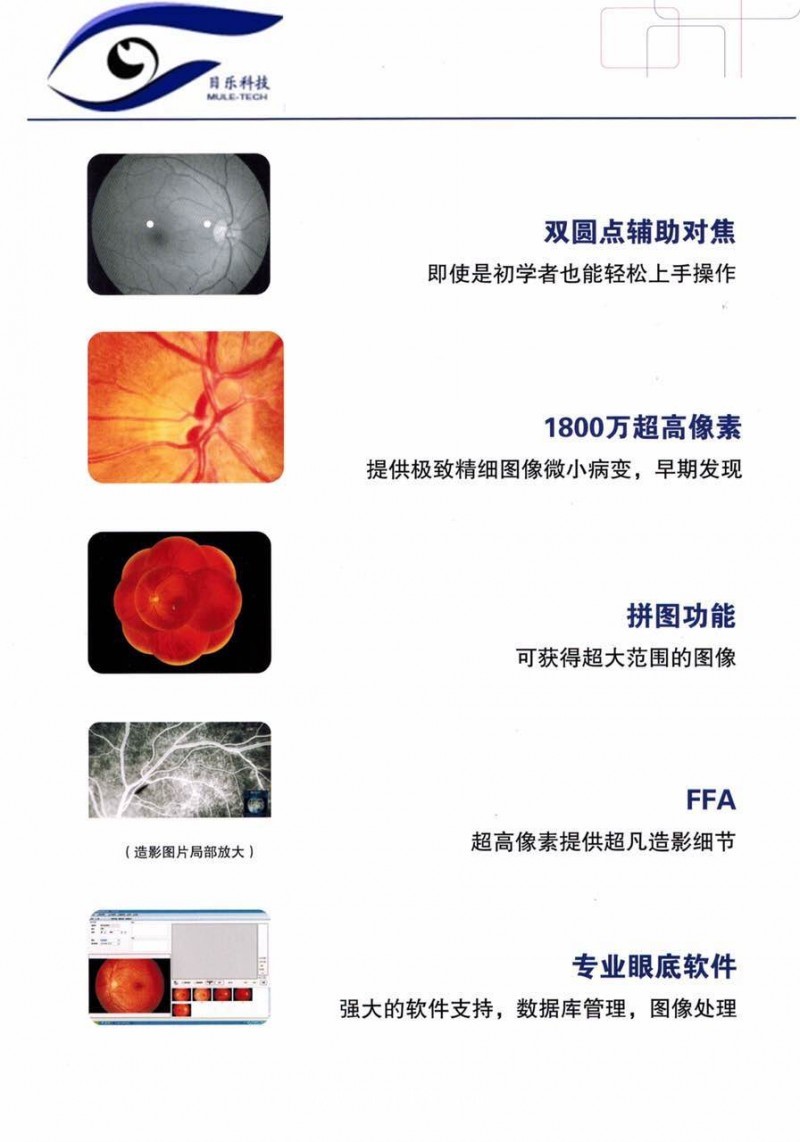 免散瞳眼底照相機(jī)