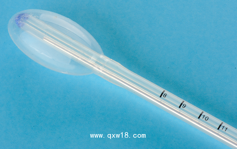 一次性球囊宮頸擴(kuò)張器