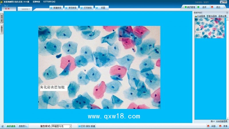 液基薄層細(xì)胞學(xué)檢測(cè)系統(tǒng) TBS TCT液基圖文報(bào)告系統(tǒng)軟件