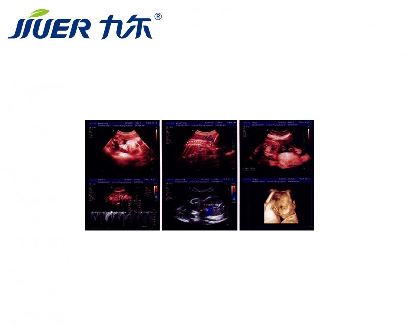 醫(yī)用X光膠片