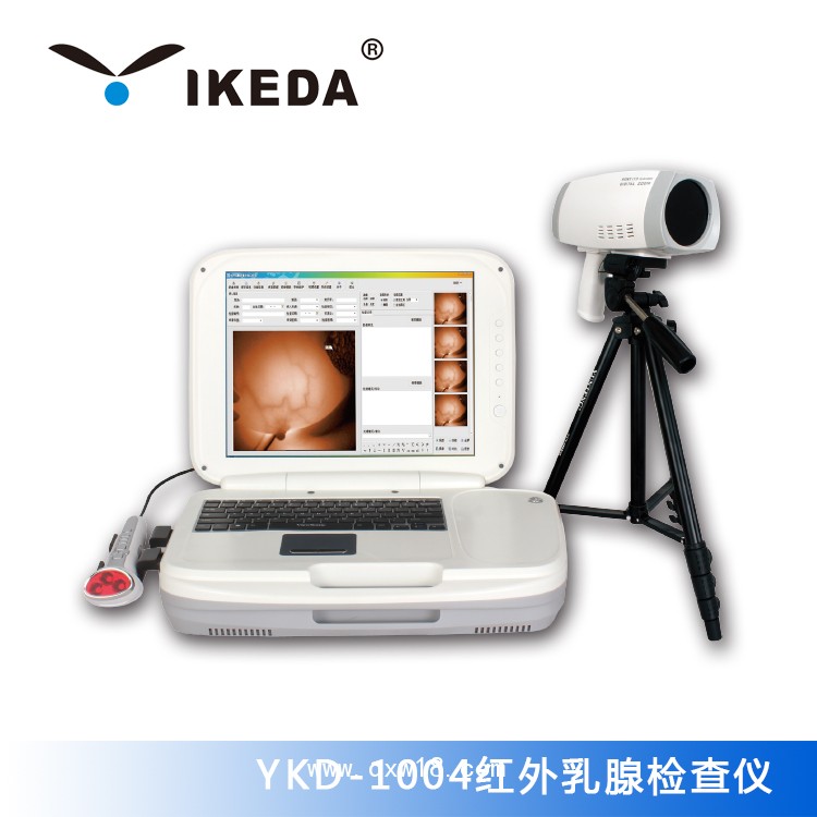 全國范圍供應(yīng)紅外乳腺檢查儀|內(nèi)窺鏡攝像機|數(shù)碼電子陰道鏡