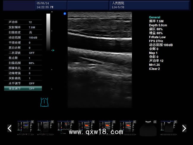b超機(jī) 彩色b超機(jī) 心臟b超機(jī) 國產(chǎn)高端b超機(jī) 腹部乳腺b超