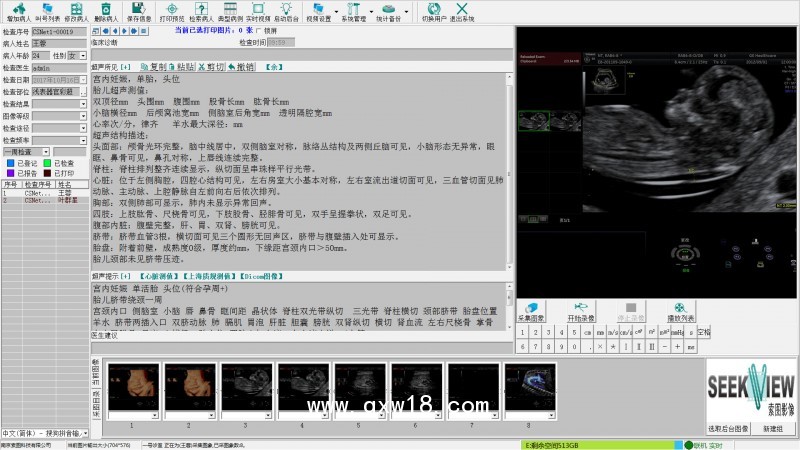 醫(yī)學(xué)影像工作站系統(tǒng)軟件