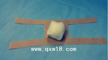 肛腸耗材一次性使用護(hù)創(chuàng)材料