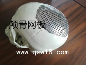 神經(jīng)外科腦外科手術器械鈦網(wǎng)顱骨網(wǎng)板連接片
