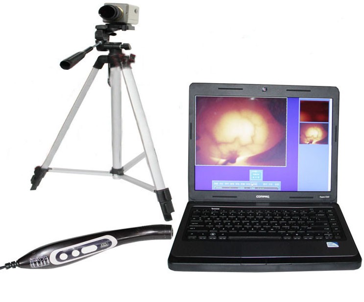 供應乳腺病檢測分析儀（紅外線乳透機）