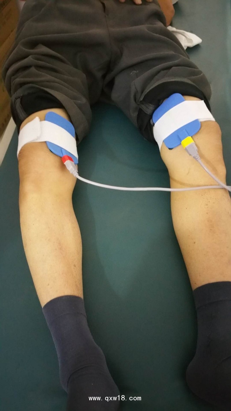 三樂SDZP-ID中醫(yī)定向治療儀