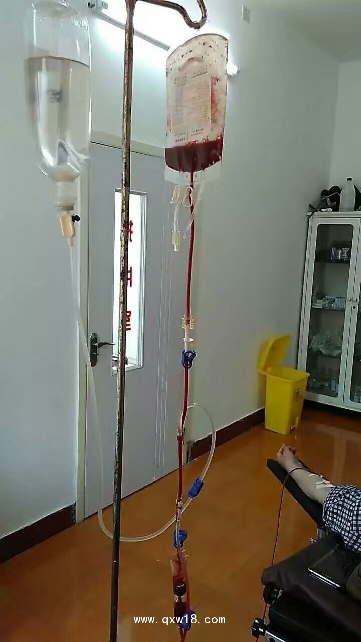 臭氧自體血血袋、萊士血袋、臭氧血袋廠家專供