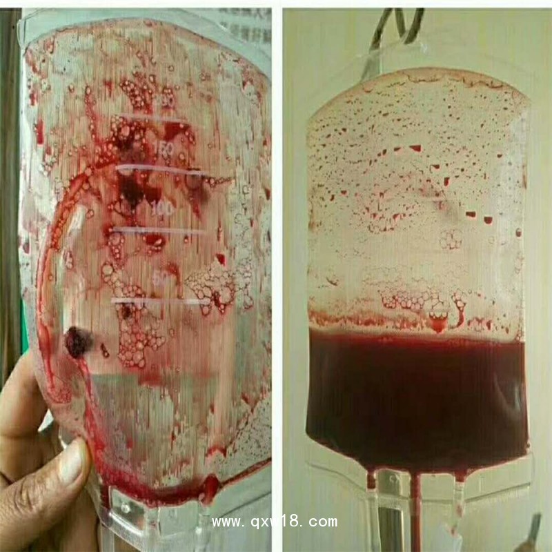 血袋、大自血血袋三大廠家南京賽爾金、蘇州萊仕、四川南格爾