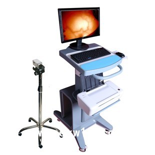 紅外乳腺檢測(cè)儀