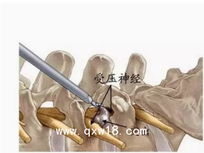 德國(guó)ASAP脊柱內(nèi)窺鏡及手術(shù)器械