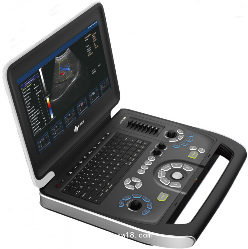 江蘇供應彩超系列筆記本彩超四維彩超