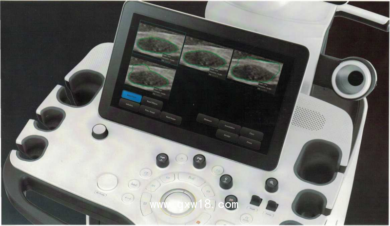 三星麥迪遜彩超機XR80A