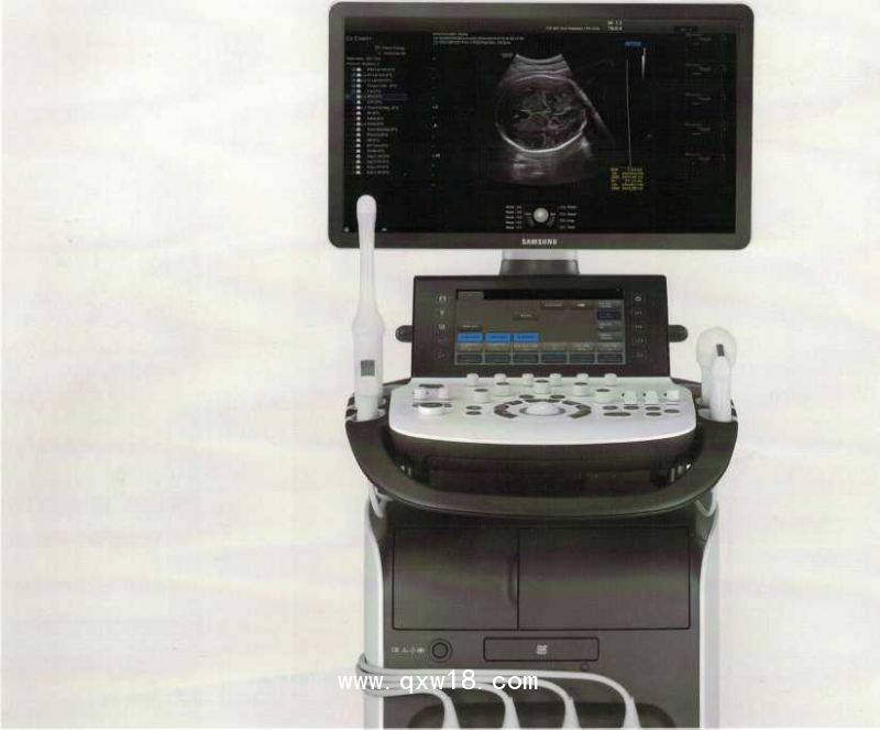 三星麥迪遜XH70A診斷超聲系統(tǒng)