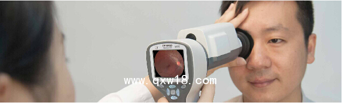 芬蘭OPTMED便攜眼底照相機