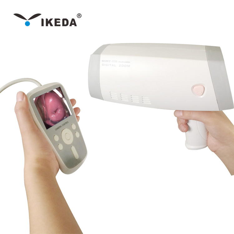 YKD-3004數碼電子陰道鏡 便攜一體化折疊式婦科檢查設備