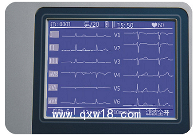 數(shù)字式心電圖機 12導聯(lián) 適合牙科醫(yī)院及民營醫(yī)院全科室使用