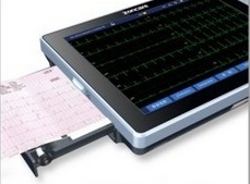 導(dǎo)聯(lián)自動(dòng)分析心電圖機(jī)