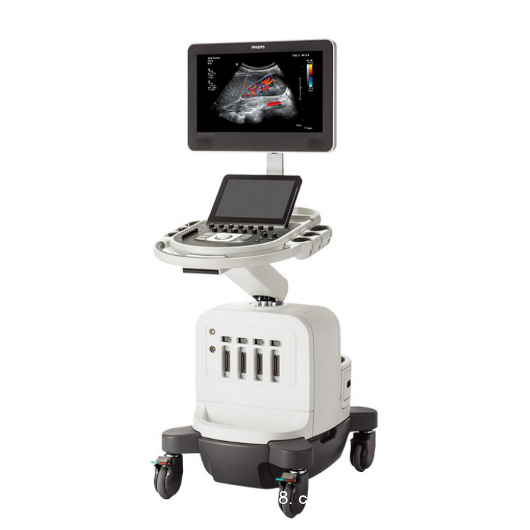 彩色超聲診斷系統(tǒng)Affiniti 70/50/30