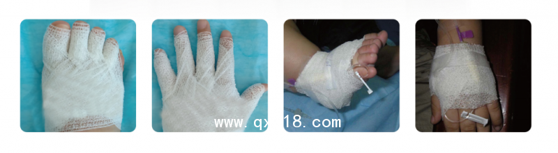 廠家供應(yīng) 醫(yī)用耗材  PBT紗布自粘彈性繃帶