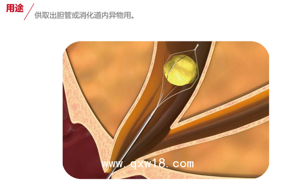 一次性使用取石網(wǎng)籃（A1三瓣花瓣形）