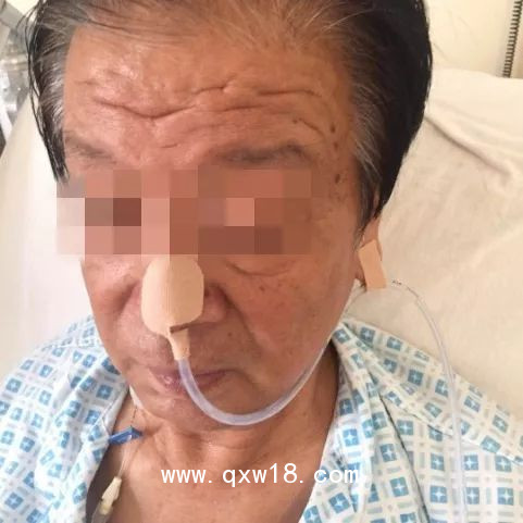 廠家供應(yīng) 鼻胃管貼 強(qiáng)粘高彈力滿涂膠帶 無殘膠