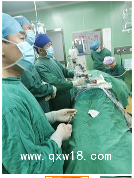 UBE 進口雙通道手術(shù)醫(yī)療器械