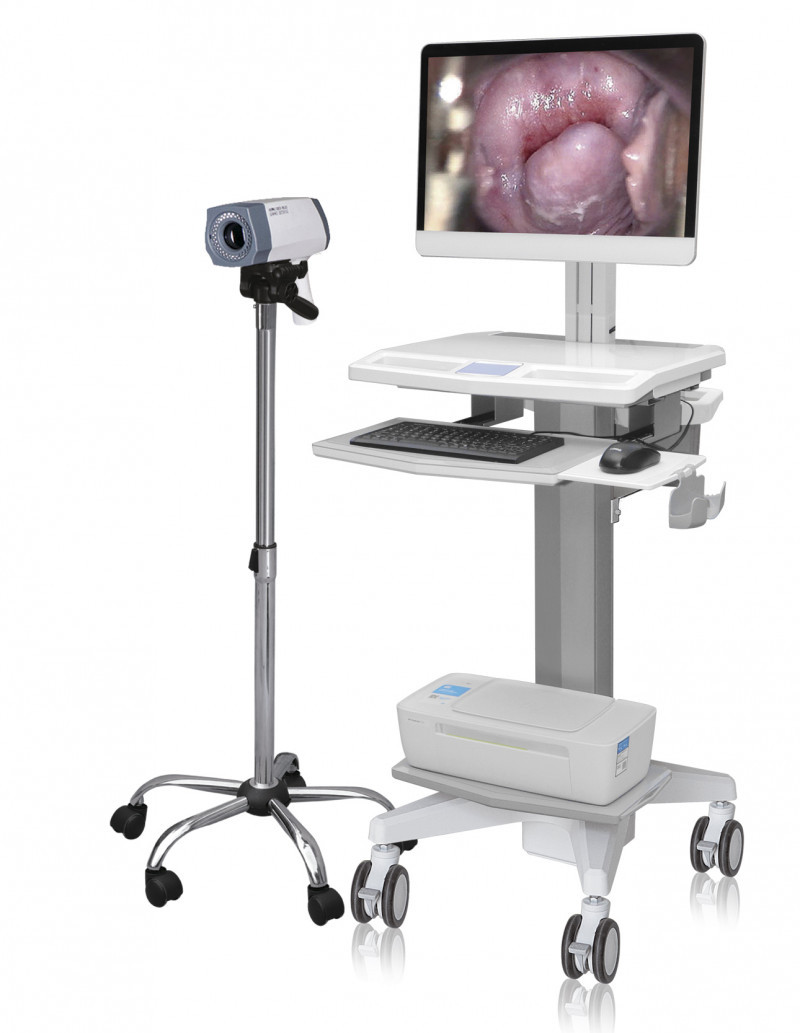 數(shù)碼電子陰道鏡