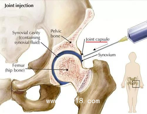 醫(yī)用臭氧治療儀