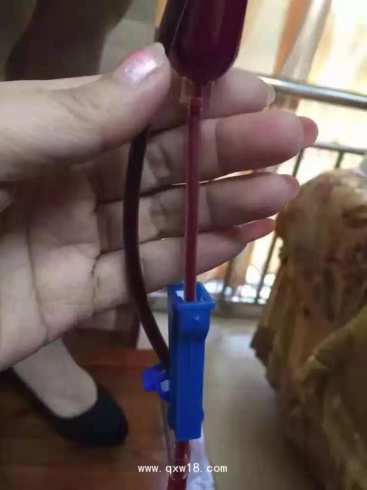 臭氧治療儀―臭氧大自血免疫療法有效治療預(yù)防高血脂