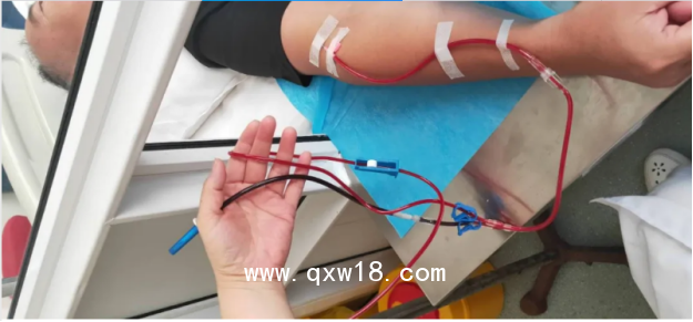 氧治療儀 臭氧大自血血袋 一次性使用輸血器