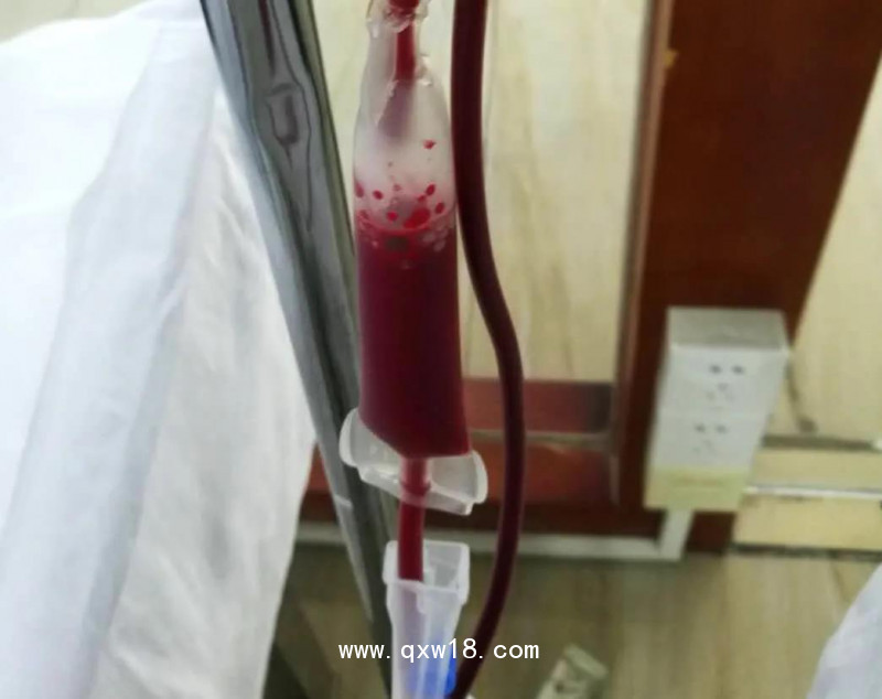 臭氧大自血療法幫患者解除疼痛與疾病困擾