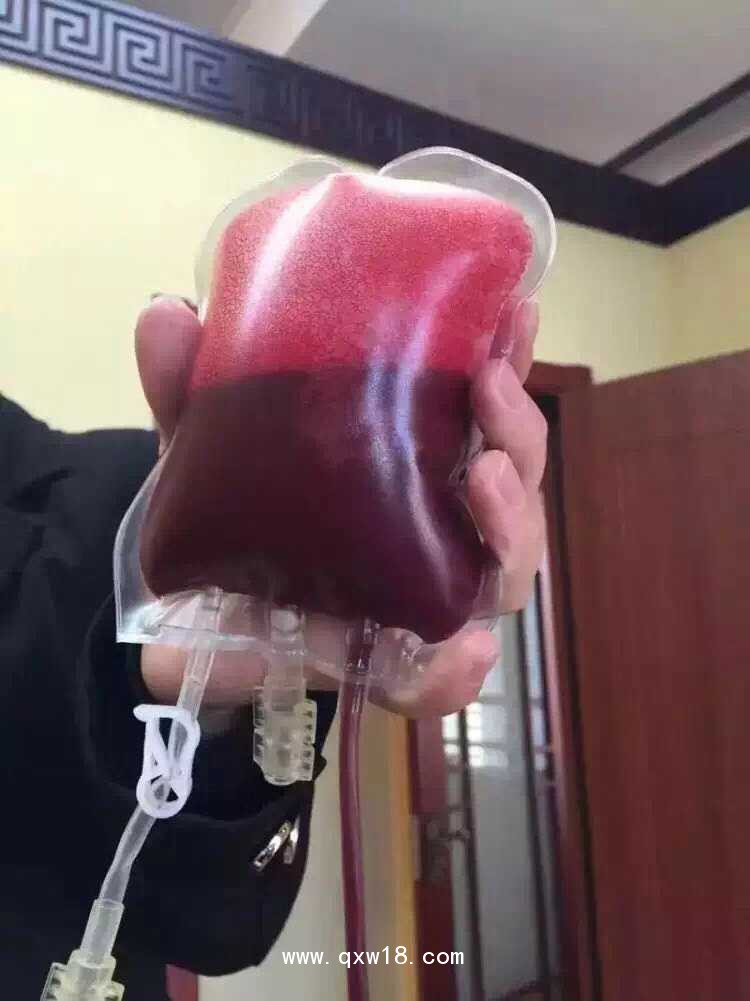 三氧大自血療法 三氧一次性耗材血袋輸血器