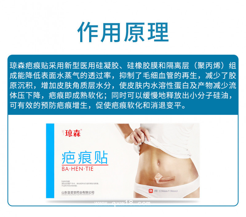 瓊森 疤痕貼 修復(fù)增生性疤痕 廠家直銷