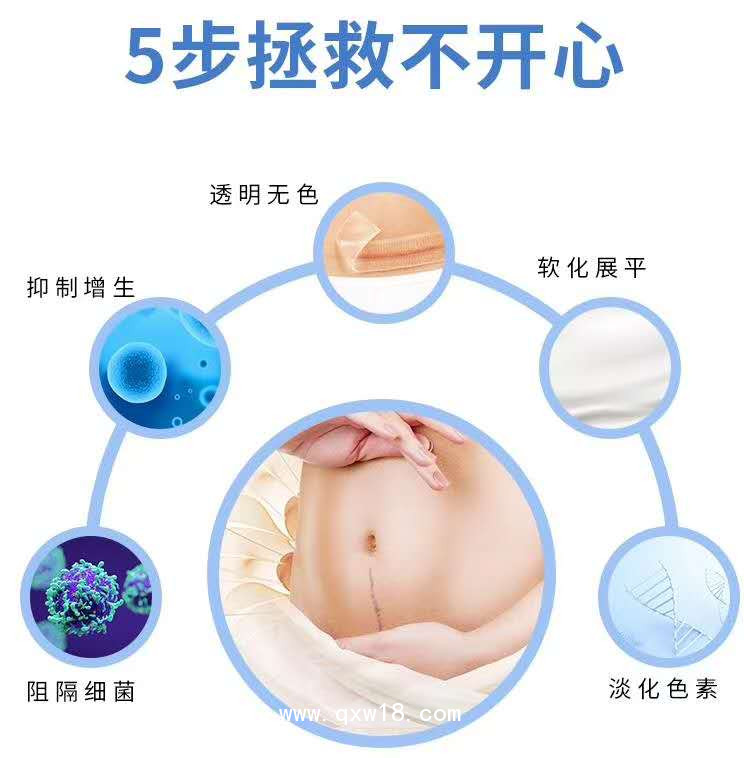 疤痕貼 疤痕修復 增生治療 貼牌代加工