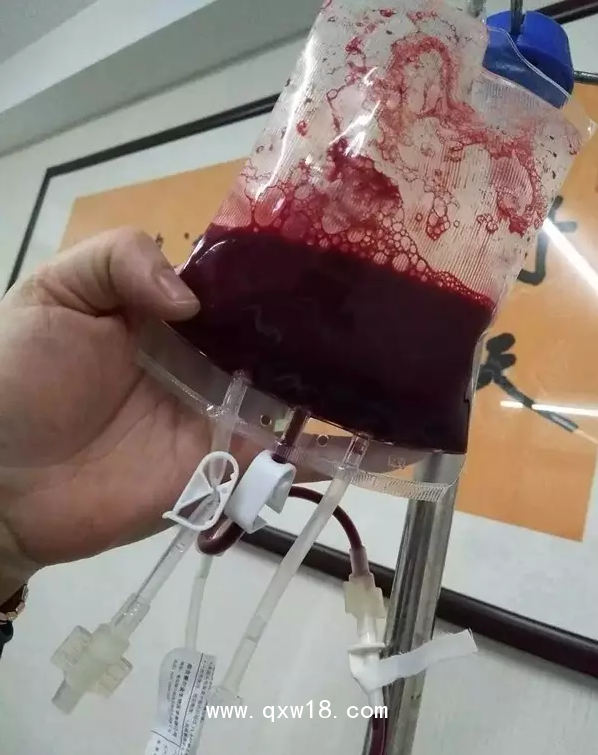 一次性大自血血袋，一次性輸血器，醫(yī)用臭氧儀等耗材產(chǎn)品批發(fā)