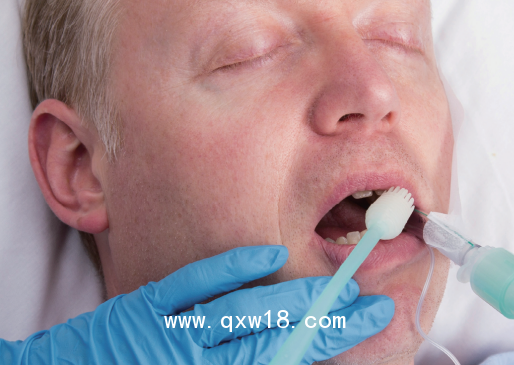 慧吉康沖吸式口護(hù)吸痰管