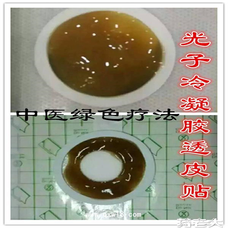 小兒肚臍醫(yī)用冷敷貼廠家加工貼牌定制廠家